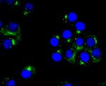 PRKAR2B Antibody in Immunocytochemistry (ICC/IF)