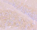 ChAT Antibody in Immunohistochemistry (Paraffin) (IHC (P))