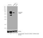 Tyrosinase Antibody in Western Blot (WB)