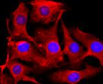 Tyrosinase Antibody in Immunocytochemistry (ICC/IF)