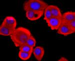 Tyrosinase Antibody in Immunocytochemistry (ICC/IF)