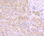 Tyrosinase Antibody in Immunohistochemistry (Paraffin) (IHC (P))