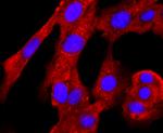 PRMT1 Antibody in Immunocytochemistry (ICC/IF)