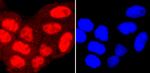 PRMT1 Antibody in Immunocytochemistry (ICC/IF)