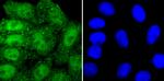 PRMT1 Antibody in Immunocytochemistry (ICC/IF)