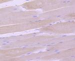 SGCG Antibody in Immunohistochemistry (Paraffin) (IHC (P))