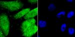 Gata-4 Antibody in Immunocytochemistry (ICC/IF)