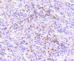 NOXA Antibody in Immunohistochemistry (Paraffin) (IHC (P))