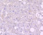 NOXA Antibody in Immunohistochemistry (Paraffin) (IHC (P))