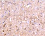 CaMKII delta Antibody in Immunohistochemistry (Paraffin) (IHC (P))