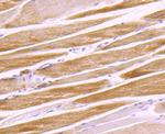 G6PD Antibody in Immunohistochemistry (Paraffin) (IHC (P))