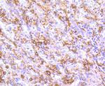 CD163 Antibody in Immunohistochemistry (Paraffin) (IHC (P))