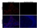 CD163 Antibody in Immunohistochemistry (Paraffin) (IHC (P))