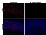 CD163 Antibody in Immunohistochemistry (Paraffin) (IHC (P))