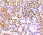 Leptin Receptor Antibody in Immunohistochemistry (Paraffin) (IHC (P))