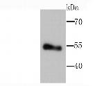 LPL Antibody in Western Blot (WB)