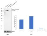 Clathrin Heavy Chain Antibody in Western Blot (WB)