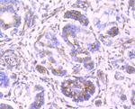 Clathrin Heavy Chain Antibody in Immunohistochemistry (Paraffin) (IHC (P))