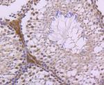 LXR alpha Antibody in Immunohistochemistry (Paraffin) (IHC (P))