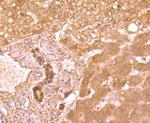 TRAIL-R2 (DR5) Antibody in Immunohistochemistry (Paraffin) (IHC (P))