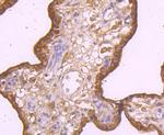 TRAIL-R2 (DR5) Antibody in Immunohistochemistry (Paraffin) (IHC (P))