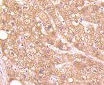 Aggrecan Antibody in Immunohistochemistry (Paraffin) (IHC (P))