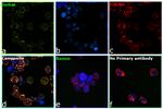 ULK1 Antibody in Immunocytochemistry (ICC/IF)