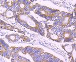 ULK1 Antibody in Immunohistochemistry (Paraffin) (IHC (P))