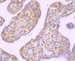 GCN2 Antibody in Immunohistochemistry (Paraffin) (IHC (P))