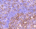 CD39 Antibody in Immunohistochemistry (Paraffin) (IHC (P))