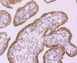 CD39 Antibody in Immunohistochemistry (Paraffin) (IHC (P))