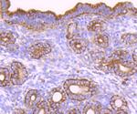 CD39 Antibody in Immunohistochemistry (Paraffin) (IHC (P))