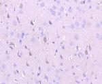 NMDAR2A Antibody in Immunohistochemistry (Paraffin) (IHC (P))