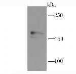 NMDAR2A Antibody in Western Blot (WB)