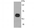 RBP4 Antibody in Western Blot (WB)