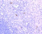 CD1a Antibody in Immunohistochemistry (Paraffin) (IHC (P))