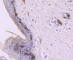 CD1a Antibody in Immunohistochemistry (Paraffin) (IHC (P))