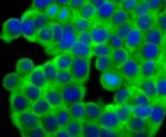 Fascin Antibody in Immunocytochemistry (ICC/IF)