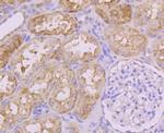 INSRR Antibody in Immunohistochemistry (Paraffin) (IHC (P))