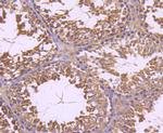 INSRR Antibody in Immunohistochemistry (Paraffin) (IHC (P))