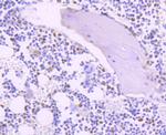 Thymidylate Synthase Antibody in Immunohistochemistry (Paraffin) (IHC (P))