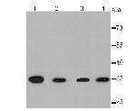 Thymidylate Synthase Antibody in Western Blot (WB)