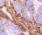 TGFBI Antibody in Immunohistochemistry (Paraffin) (IHC (P))