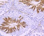 ACE Antibody in Immunohistochemistry (Paraffin) (IHC (P))