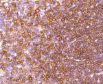 c-Rel Antibody in Immunohistochemistry (Paraffin) (IHC (P))