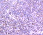 PIK3CD Antibody in Immunohistochemistry (Paraffin) (IHC (P))