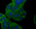 gamma Synuclein Antibody in Immunocytochemistry (ICC/IF)