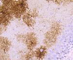 gamma Synuclein Antibody in Immunohistochemistry (Paraffin) (IHC (P))