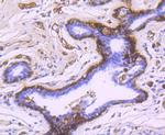 gamma Synuclein Antibody in Immunohistochemistry (Paraffin) (IHC (P))