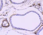 gamma Synuclein Antibody in Immunohistochemistry (Paraffin) (IHC (P))